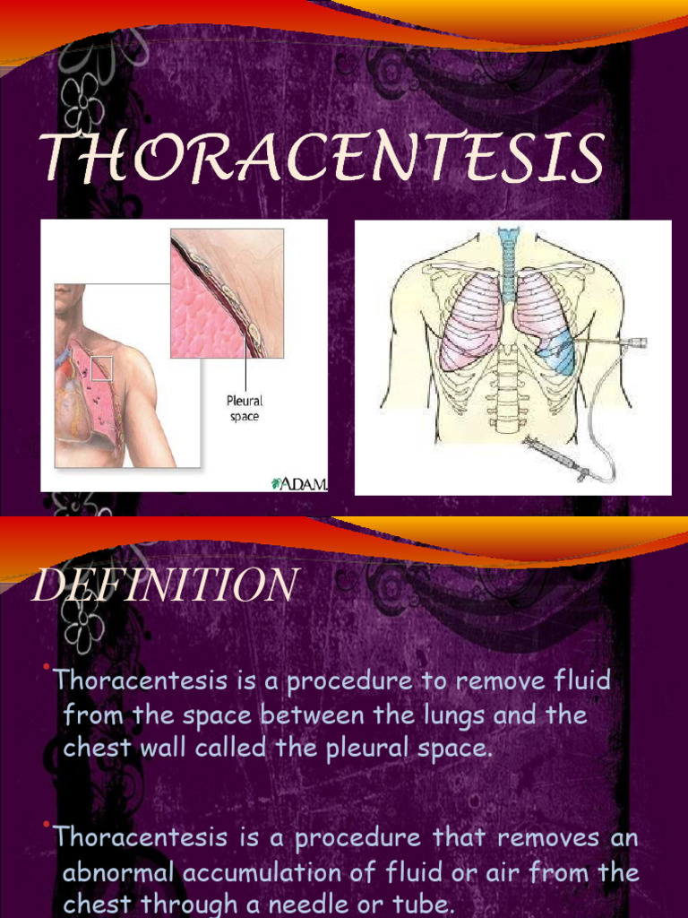 Thoracentesis vs Paracentesis Explained | PDF | Diseases And Disorders ...