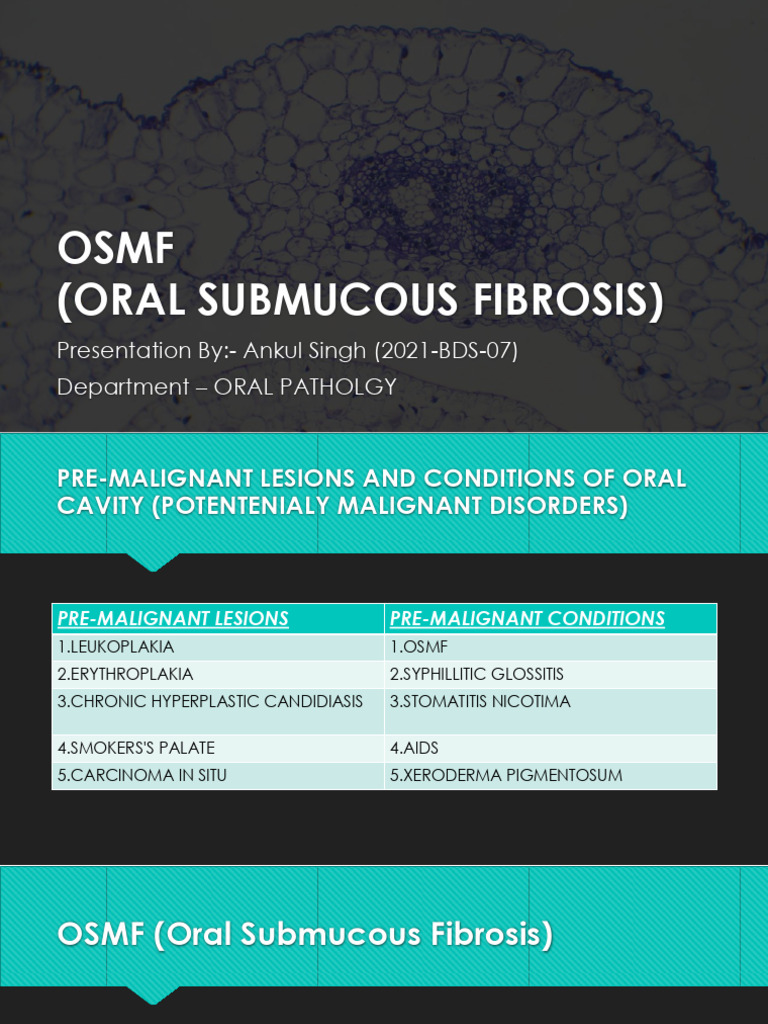 Understanding Oral Submucous Fibrosis | PDF