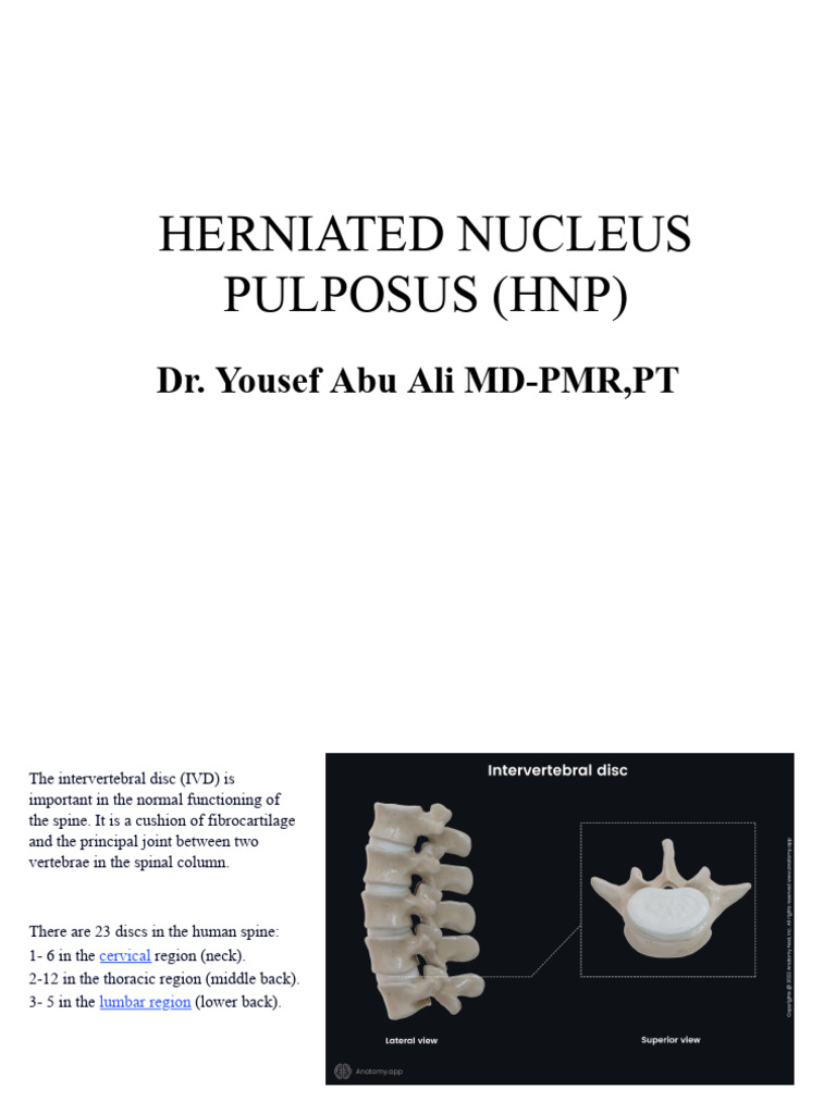 Understanding Herniated Nucleus Pulposus | PDF | Vertebral Column ...