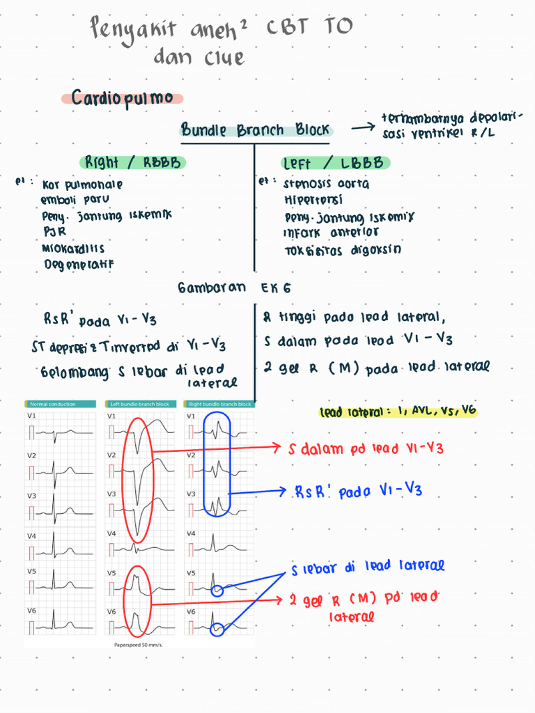My NOTES BBB Vs RBBB | PDF