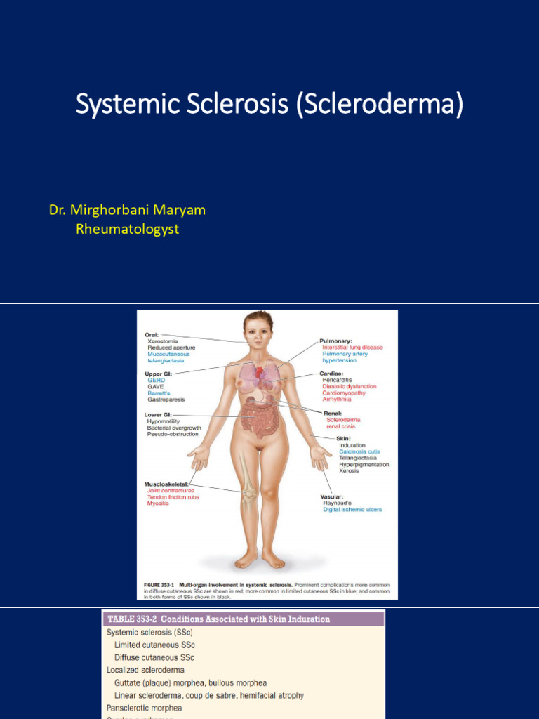 Scleroderma: Diagnosis and Management | PDF | Ischemia | Medical ...
