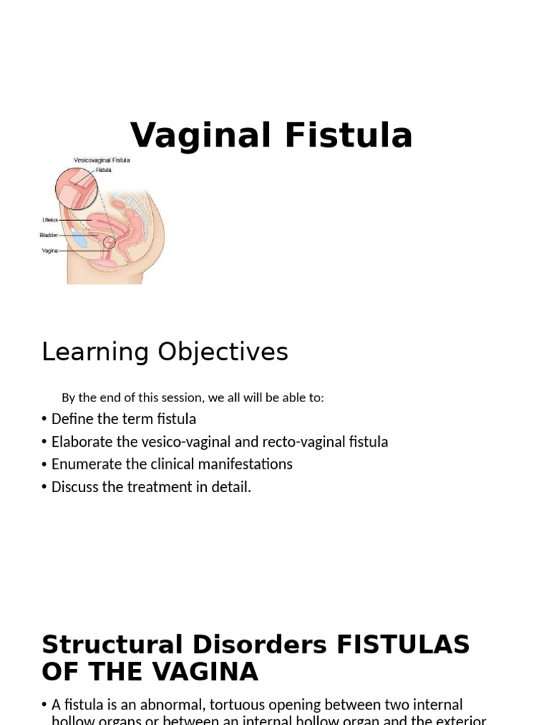 vaginal-fistula-1-pdf-vagina-medical-specialties