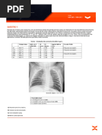 Escala Alsfrs-R 2 | PDF | Especialidades médicas