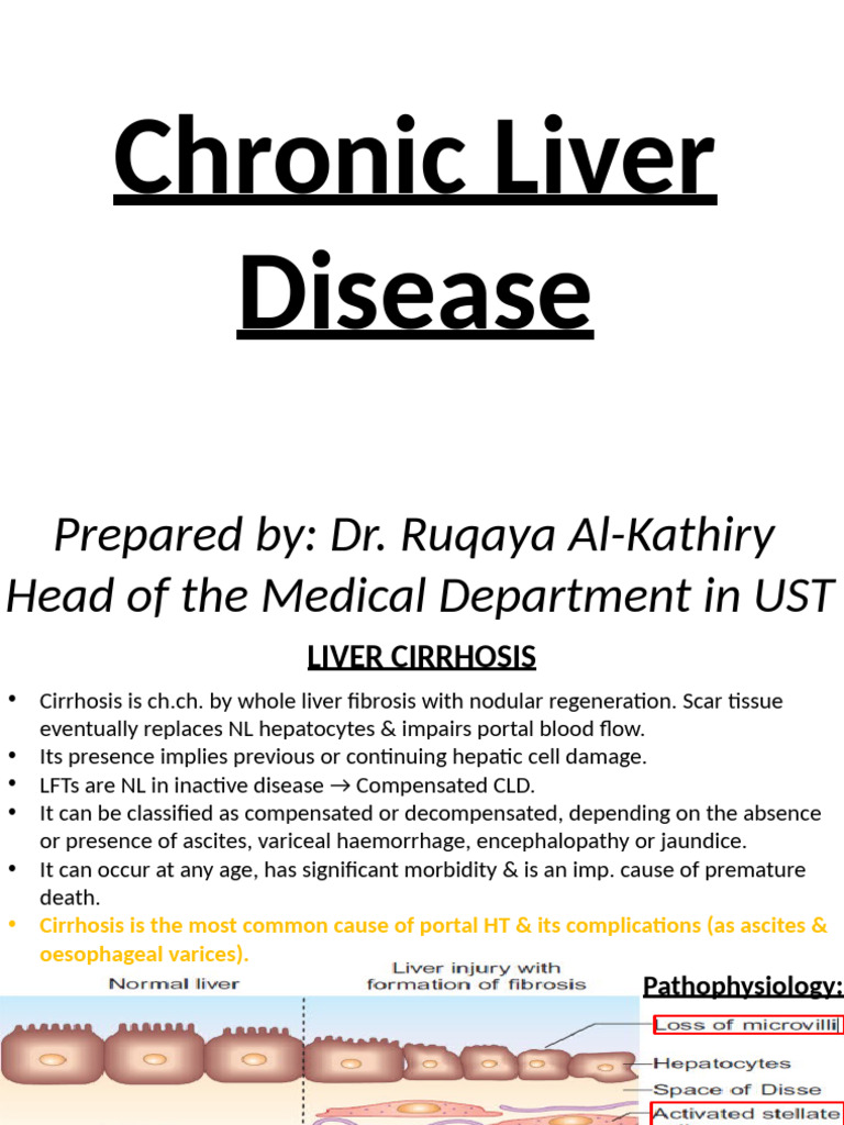 Understanding Chronic Liver Disease | PDF | Cirrhosis | Liver