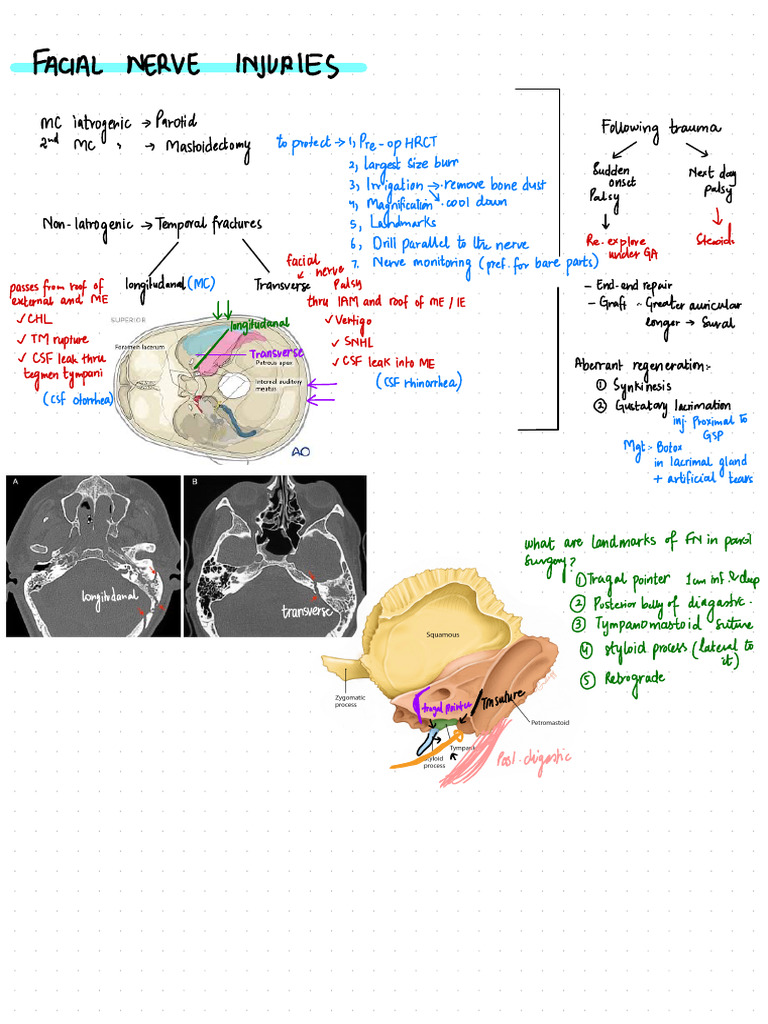 Facial Nerve Injuries: Management & Anatomy | PDF | Diseases And ...