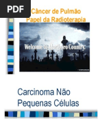 CancerdePulmao_radioterapia