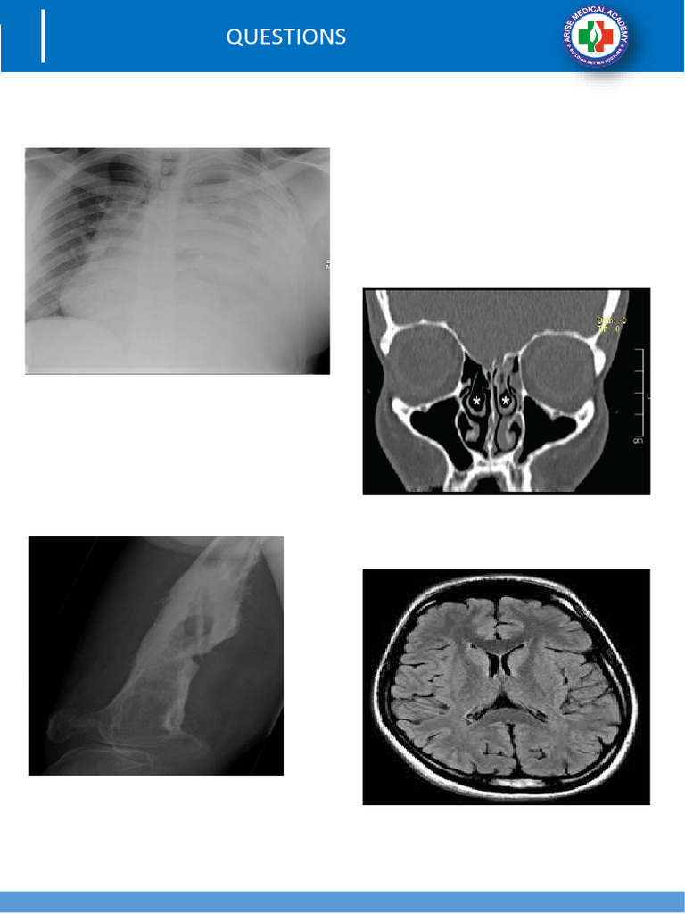 NEET SS Radiology Question Bank PDF | PDF | Ct Scan | Interventional ...