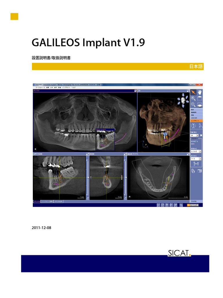 GALILEOS Implant V1.9 | PDF