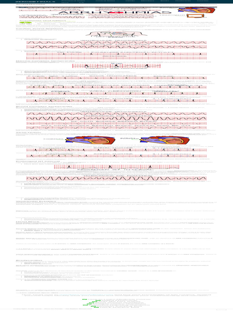Understanding Arrhythmias and Heart Block | PDF | Heart | Cardiology