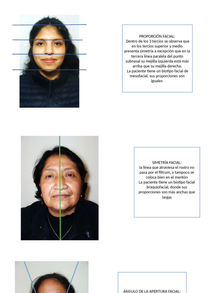 Analisis Facial | PDF