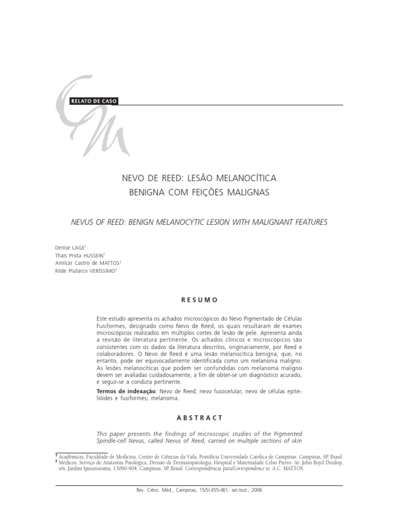 Nevo de Reed: Lesão Benigna com Risco Maligno | PDF | Melanoma | Câncer