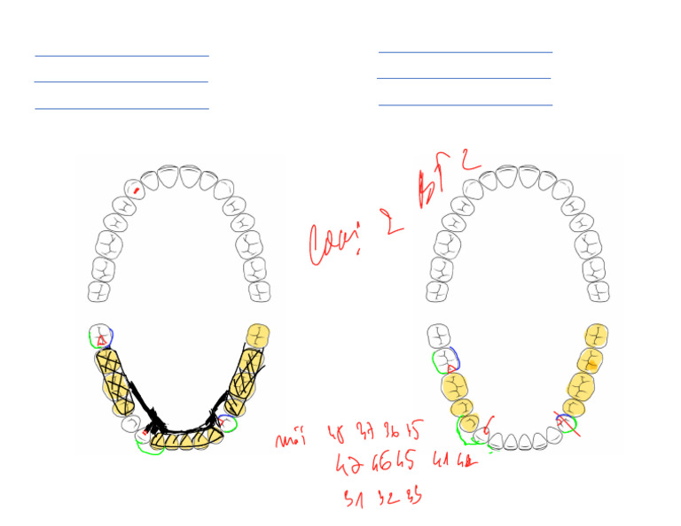 RPD Design Sheet 3 | PDF