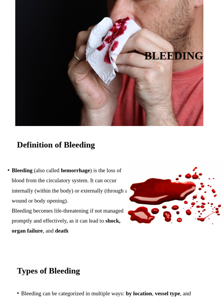 First Aid Management of Bleeding | PDF | Bleeding | Medical Specialties