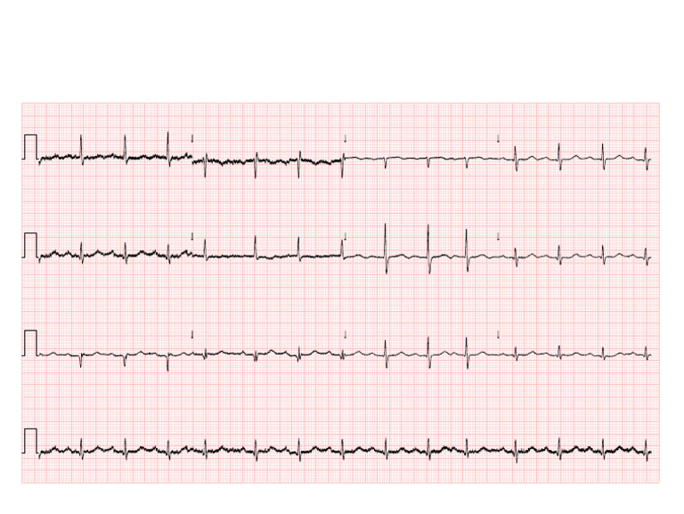 R^ECG^_0_^^^_20230228181218_20230228155124 | PDF