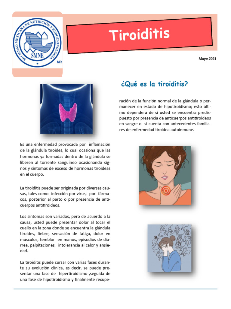 12 Tiroiditis | PDF | Hipotiroidismo | Enfermedades y trastornos