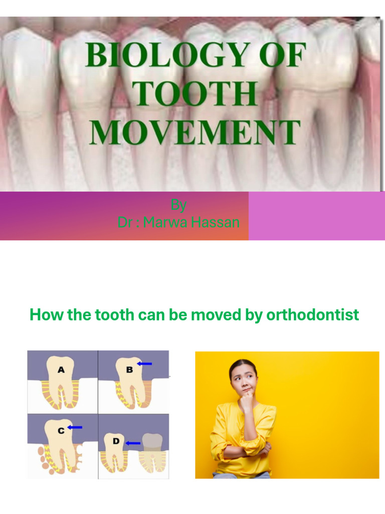 Understanding Orthodontic Tooth Movement | PDF
