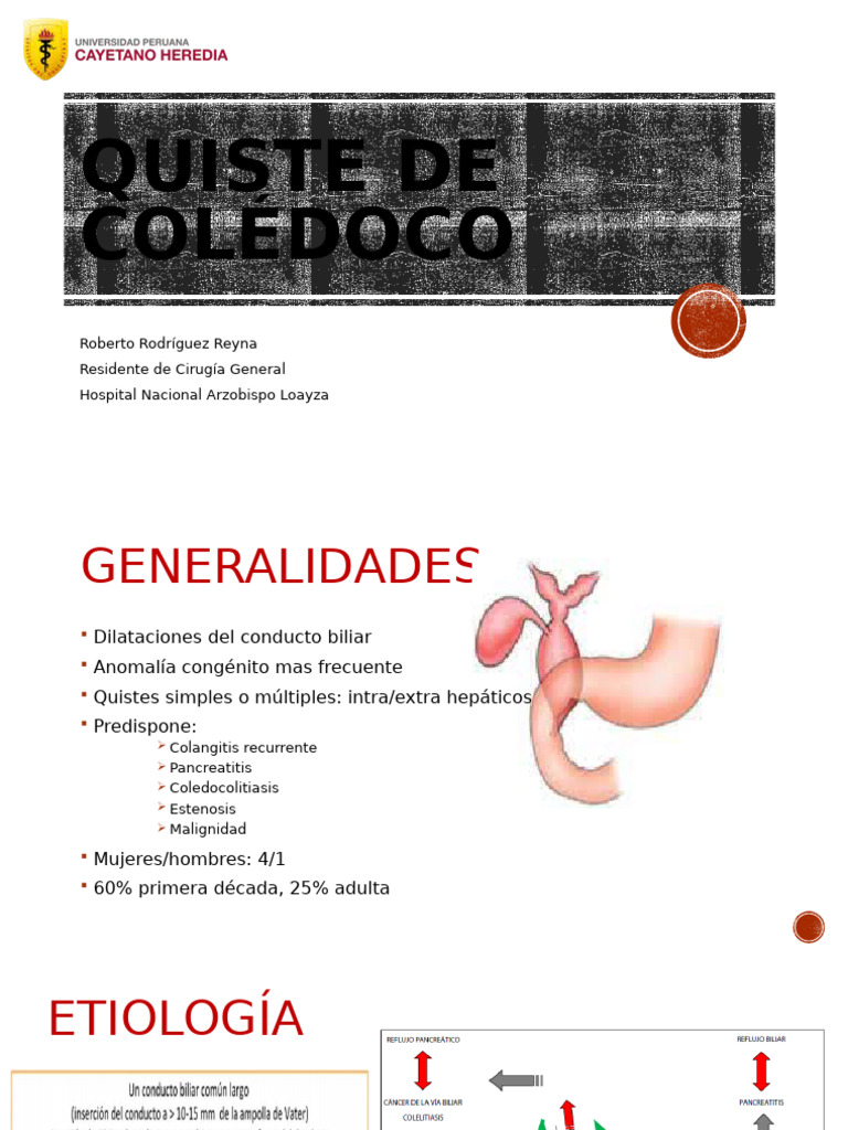Quiste de Colédoco: Clasificación y Manejo | PDF | Vesícula biliar ...