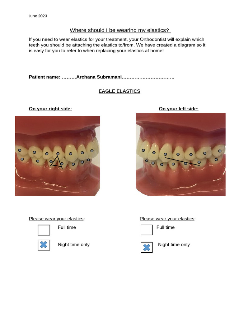 As Elastics | PDF