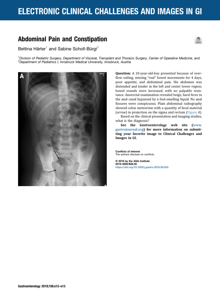 Fecal Impaction from Rectal Bezoars | PDF | Rectum | Constipation