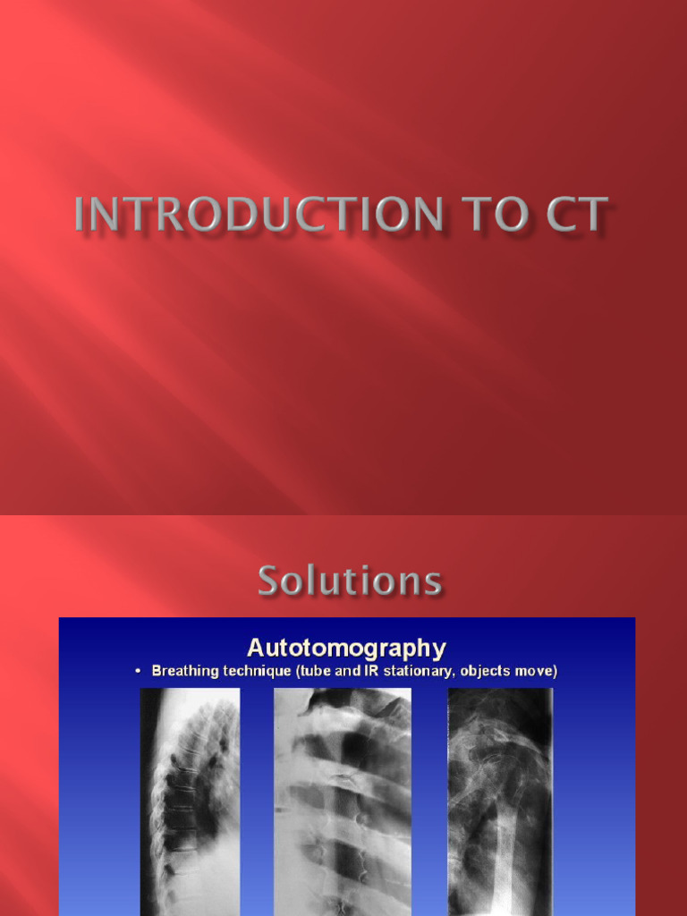 Wa0001. | PDF | Ct Scan | Tomography