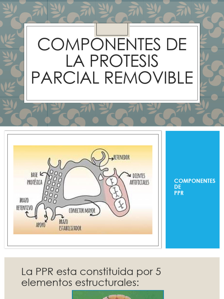 Componentes de la Prótesis Parcial Removible | PDF | Diente | Odontología