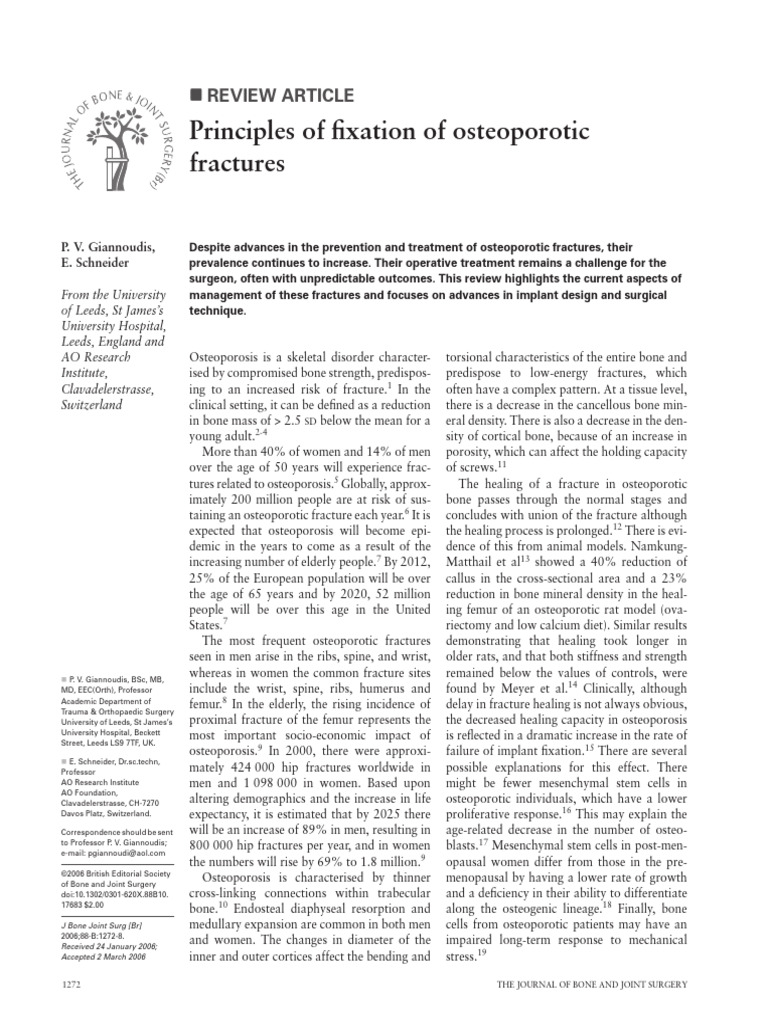 Principles of Fixation of Osteoporotic Fractures | PDF | Osteoporosis ...
