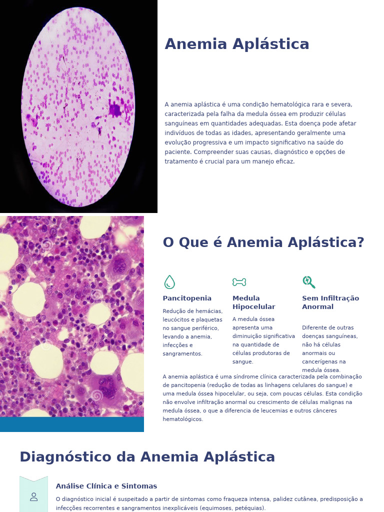 Aplástica 1 | PDF | Anemia | Sangue