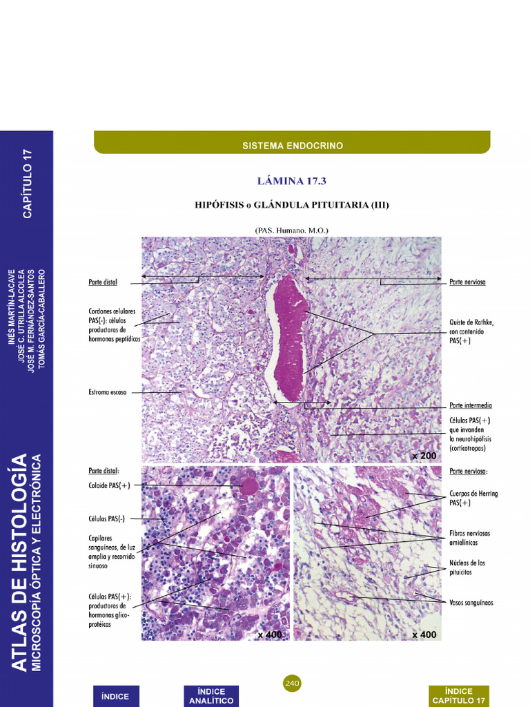 PT11 | PDF