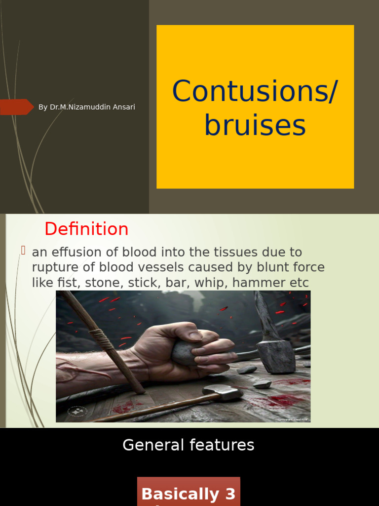 Contusions | PDF | Medical Specialties | Diseases And Disorders