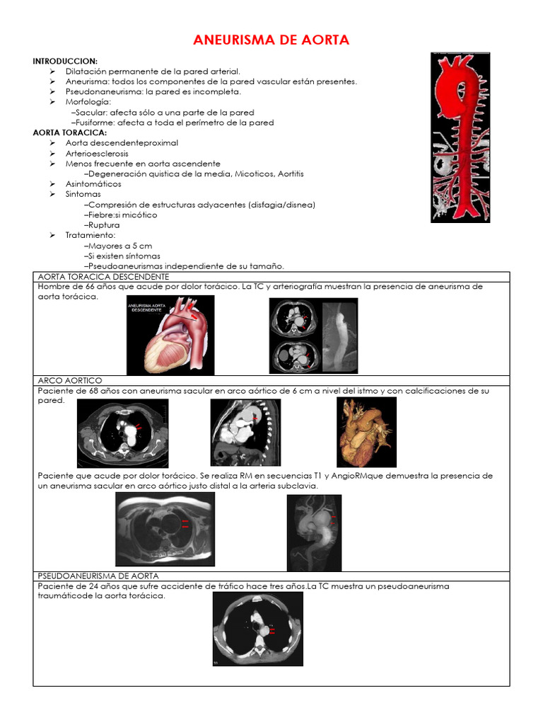 Aneurismas de Aorta | PDF | Aorta | Enfermedades y trastornos
