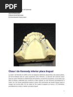 Ganchos Wipla para Prótesis Dentales | PDF
