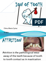 Attrition - Omr