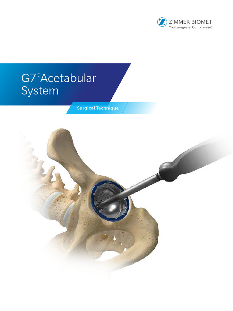 G7 Acetabular Surgical Technique Guide | PDF
