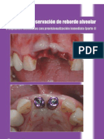 Regularizacion Del Reborde