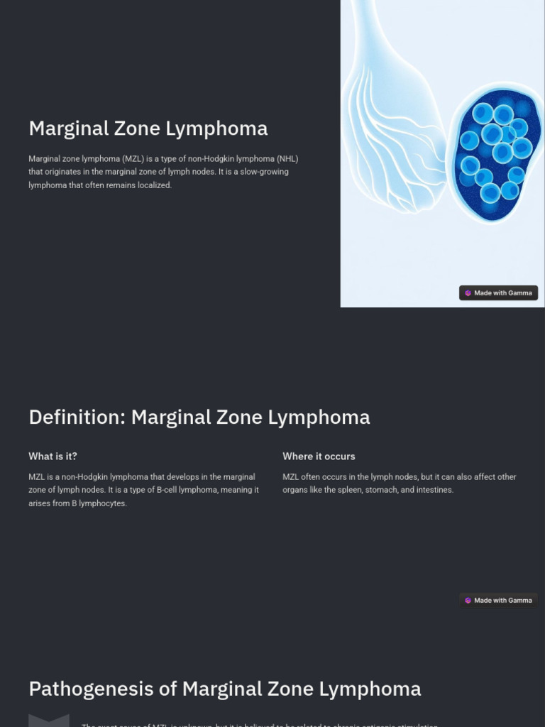 Marginal Zone Lymphoma Overview | PDF