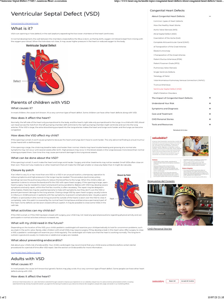 Understanding Ventricular Septal Defect | PDF | Congenital Heart Defect ...