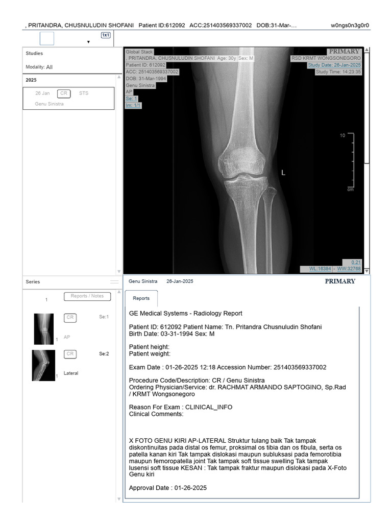 Rontgent Lutut 26 Jan 25 | PDF | Health Sciences | Skeletal System