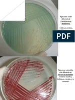 Fotos para Comparação de Colôinias de Bacterias