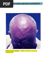 Atlas de Hansen Parte 3