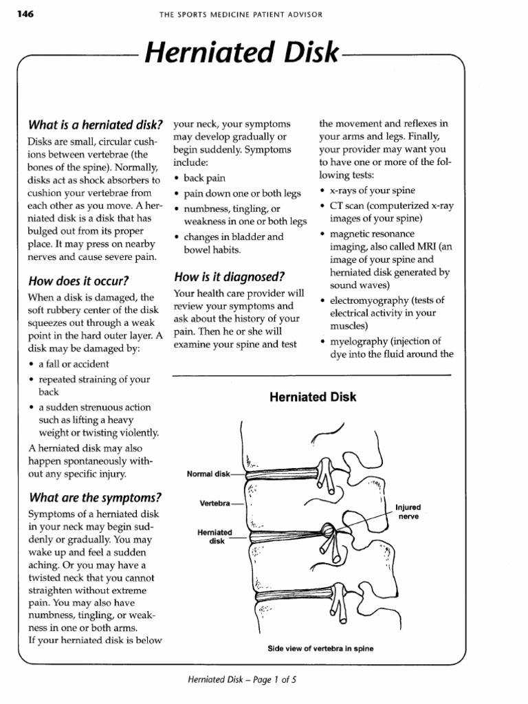 150 - Herniated Disc | PDF