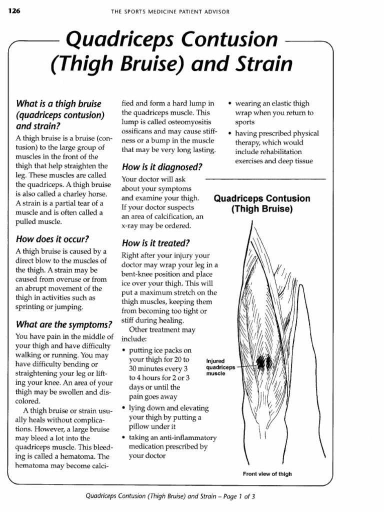 145 - Quad Strain | PDF