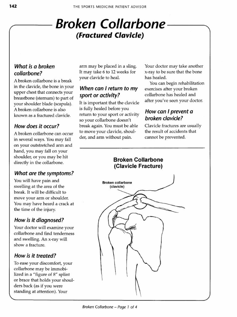 159 - Clavicle Fracture | PDF
