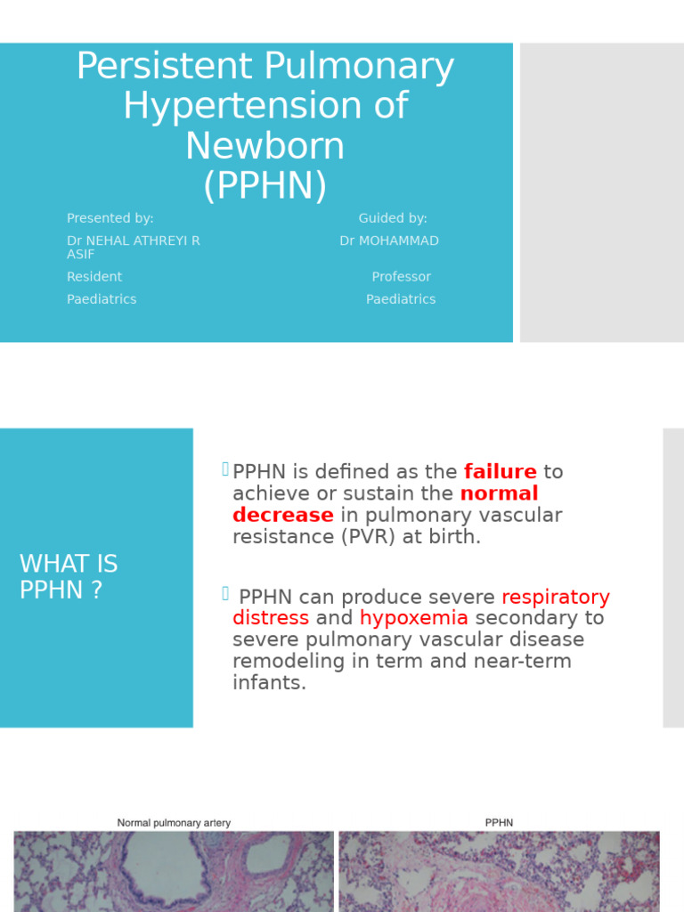 DR Nehal Seminar PPHN Draft 2 | PDF | Blood Vessel | Fetus