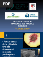 Guía TI-RADS ACR para Nódulos Tiroideos | PDF