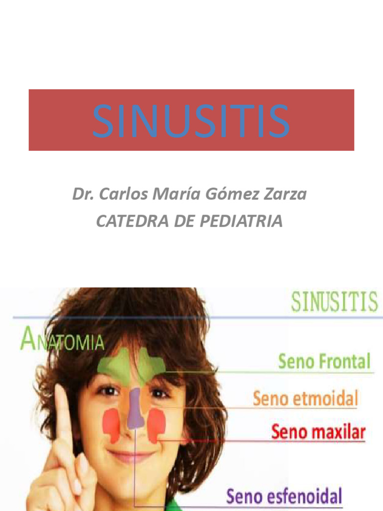 Sinusitis | PDF