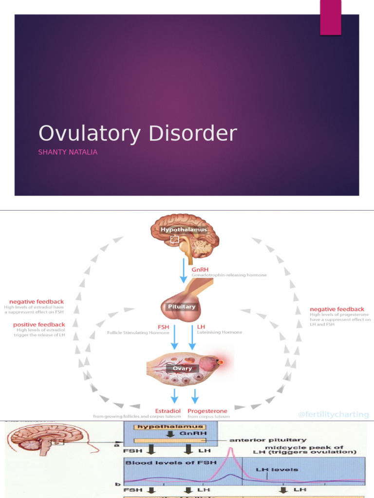 Ovulatory Disorder | PDF | Menstrual Cycle | Polycystic Ovary Syndrome