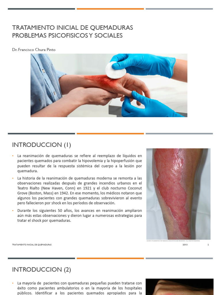 Tratamiento Inicial de Quemaduras Upt | PDF | Quemar | Herida