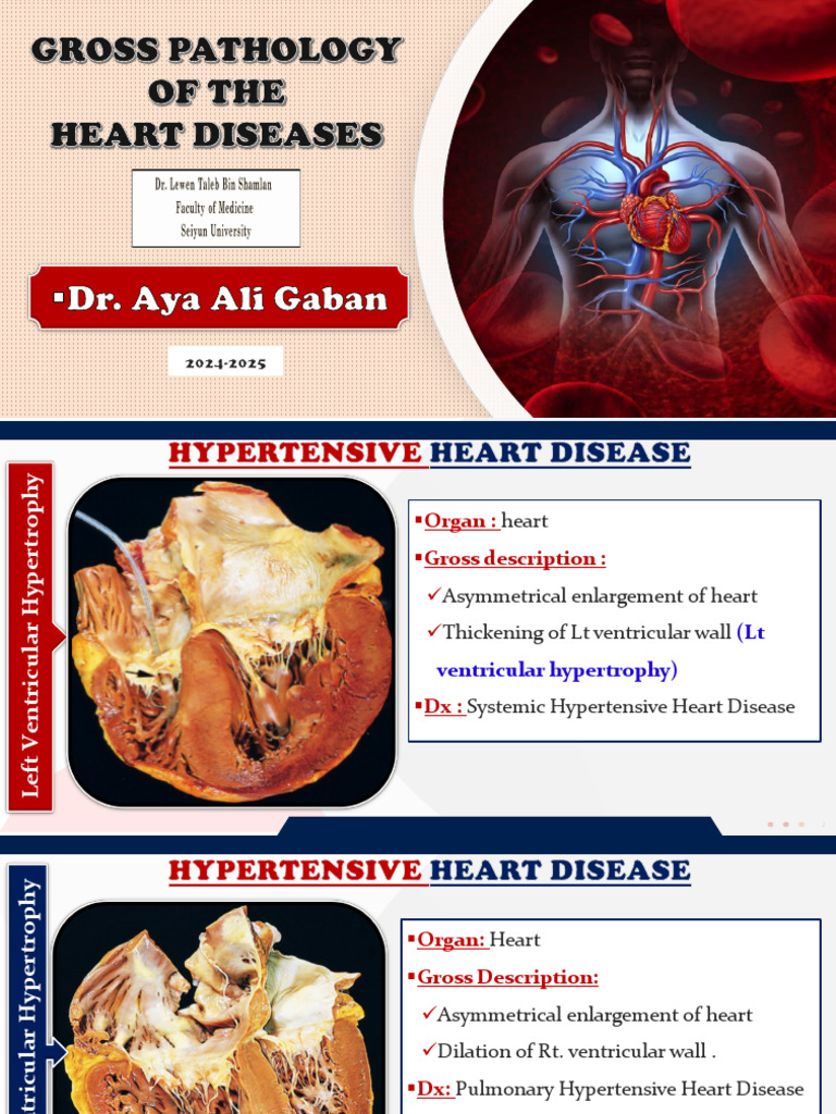 Heart Disease Gross Pathology Overview | PDF | Cardiac Muscle | Heart