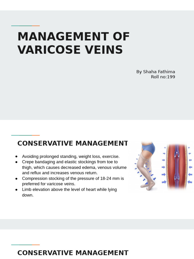 Management of Varicose Veins | PDF | Vein | Varicose Veins