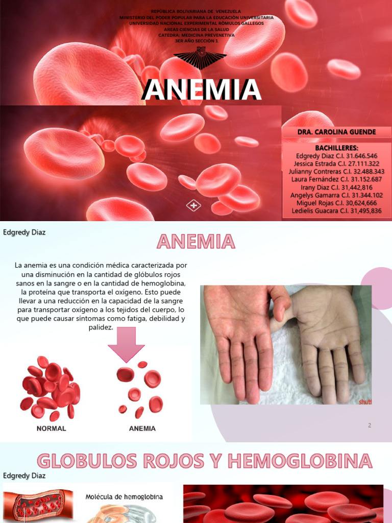 Clasificación y Síntomas de Anemia | PDF | Glóbulo rojo | Anemia